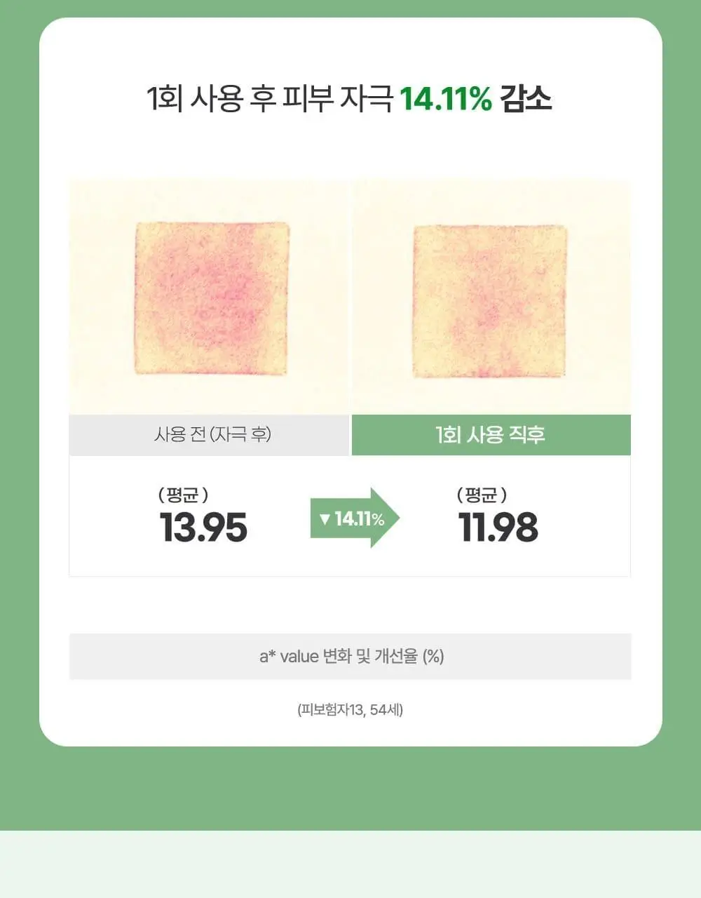 [국민크림] 김정문알로에 큐어크림 50g 상세페이지 10